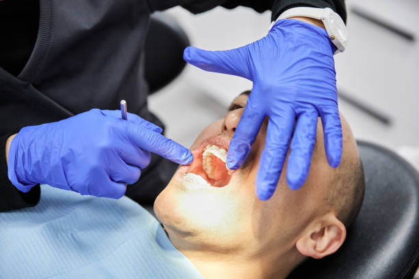 Best Dentist for Tooth Abscess  in Pomona, KS